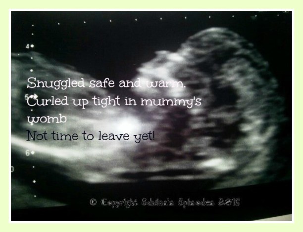 Baby Scan pic.jpg